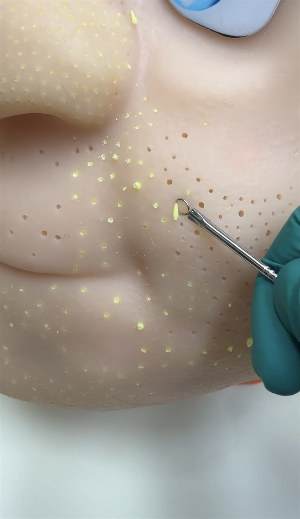 Eco-Friendly Realistic Acne Popping Stress Relief Toy - Big Head Pimple Squeezer For Anxiety Relief