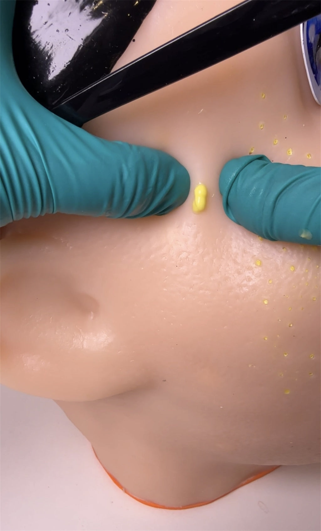 Eco-Friendly Realistic Acne Popping Stress Relief Toy - Big Head Pimple Squeezer For Anxiety Relief