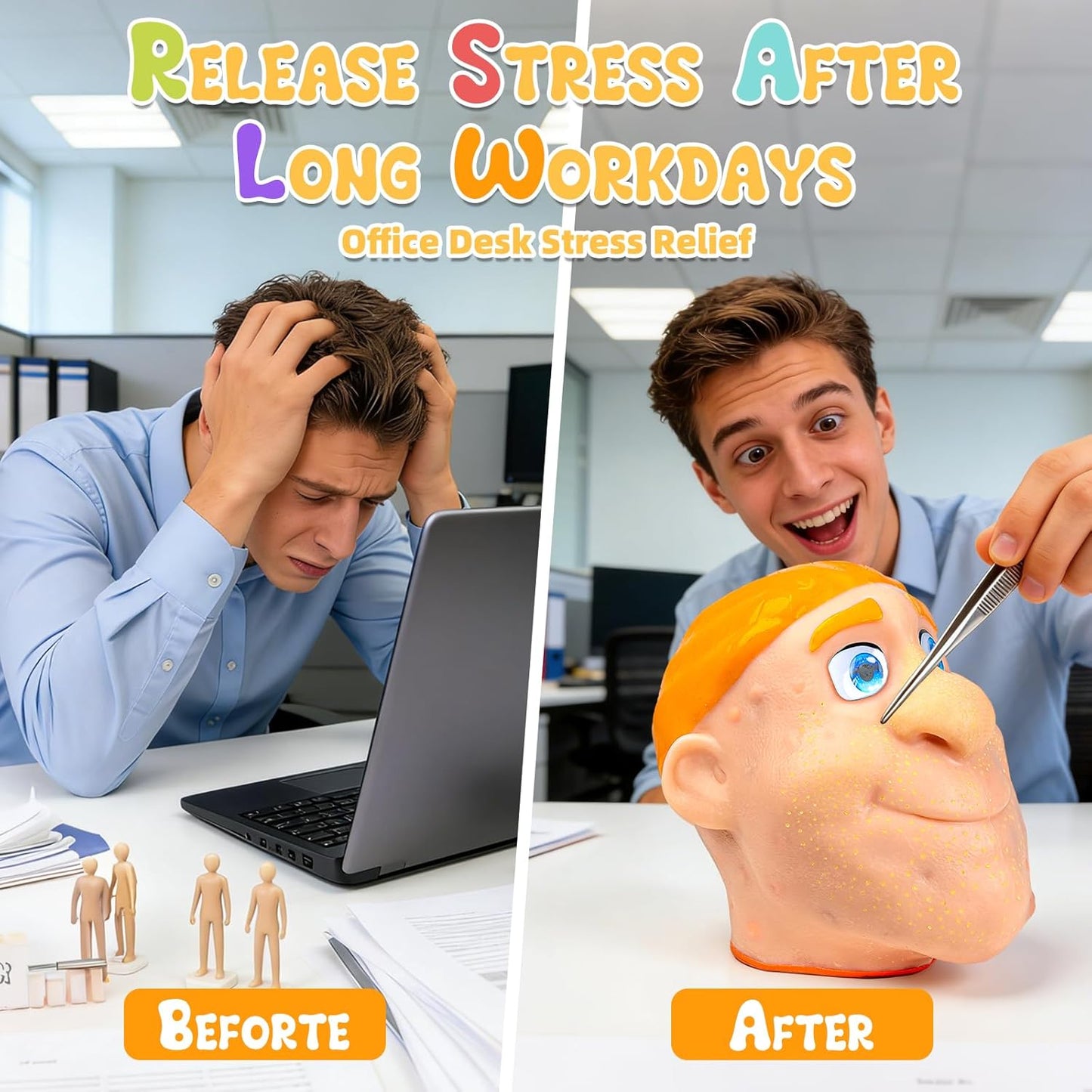Realistic Acne Popping Stress Relief Toy - Big Head Pimple Squeezer For Anxiety Relief